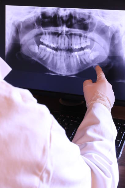 Best Emergency Treatment for Toothache in Henderson, LA